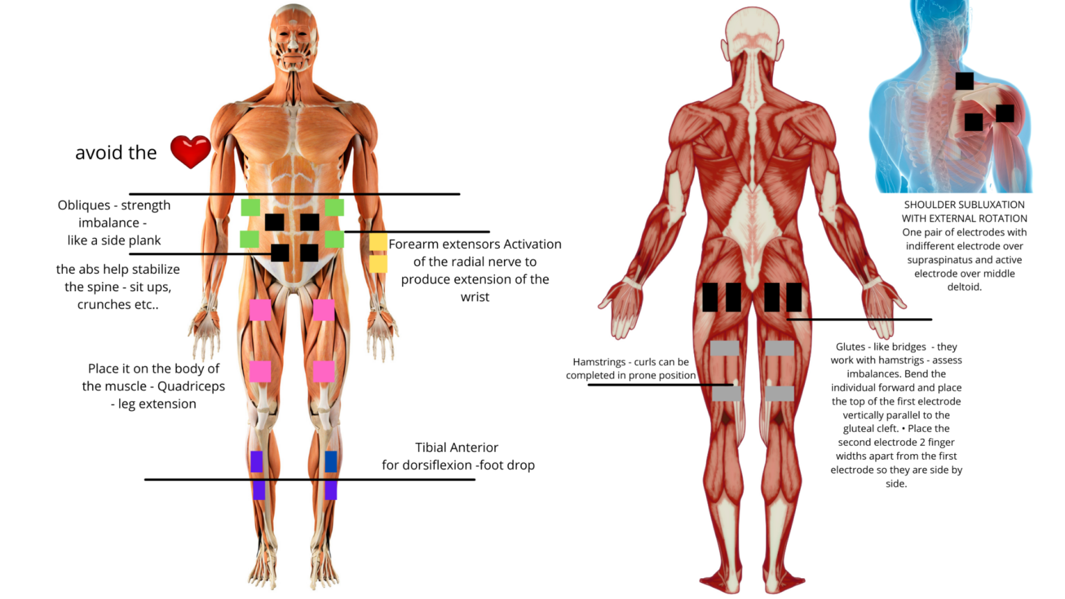 A Beginner’s Guide to FES Therapy What it is and How it Works! Mindly Body